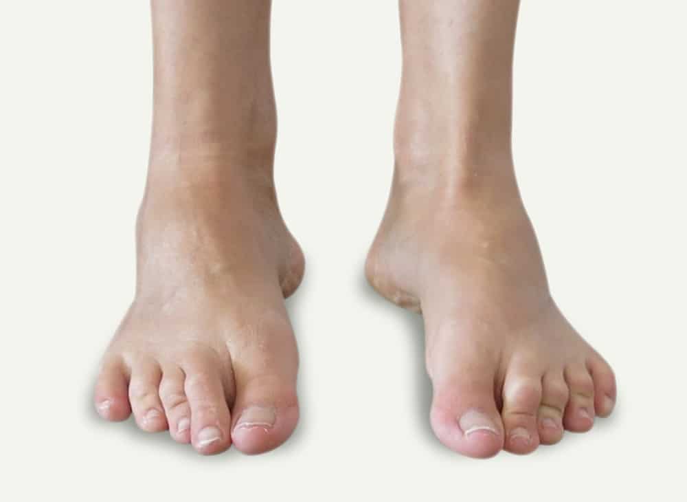 Supination - Davenport House Clinic