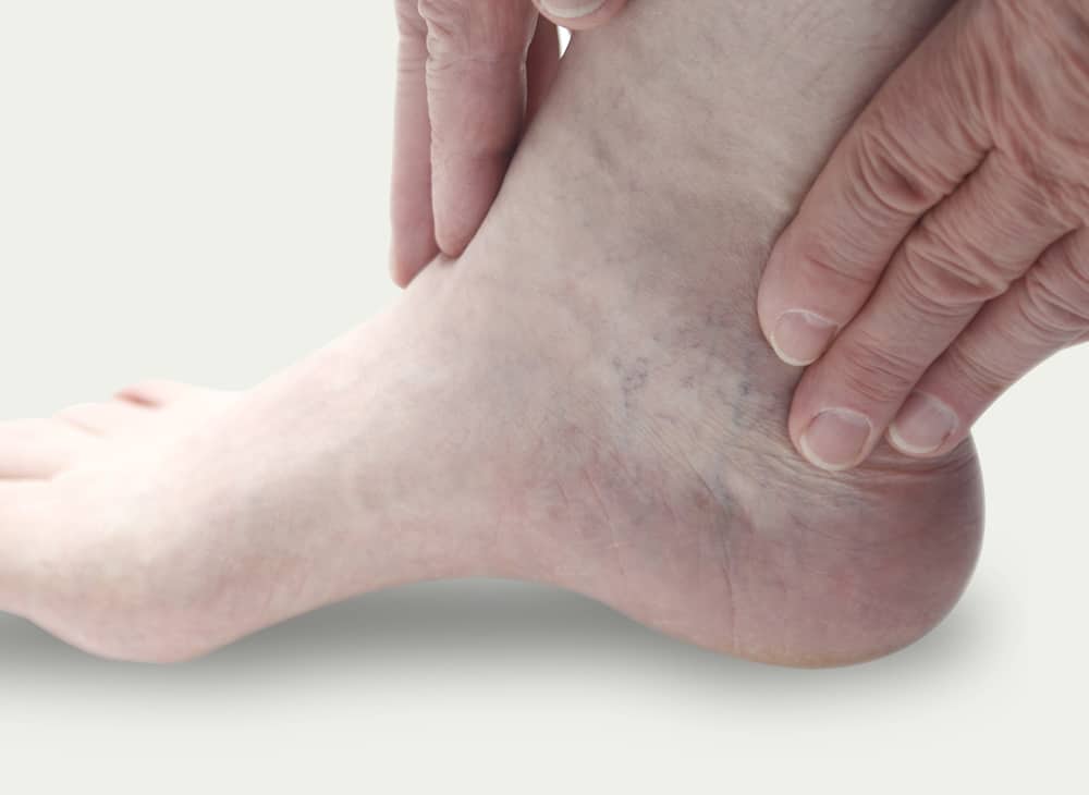 tarsal tunnel syndrome