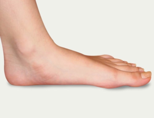 Flat Feet