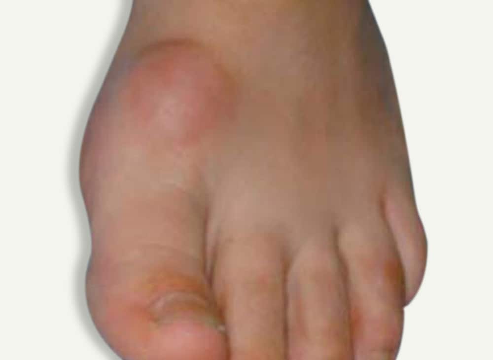 Supination - Davenport House Clinic